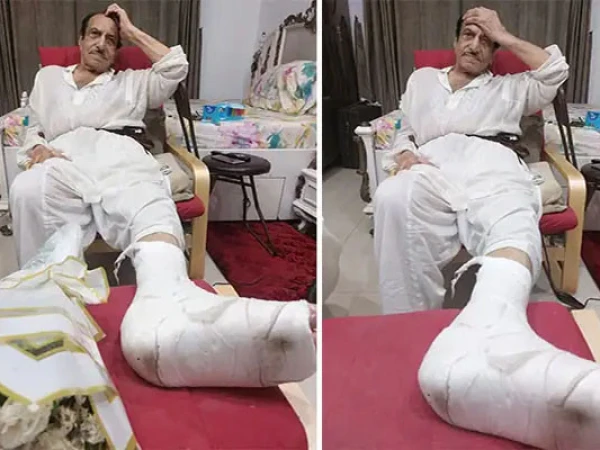 mustafa-qureshi-leg-fractured1760452309-0-600x450