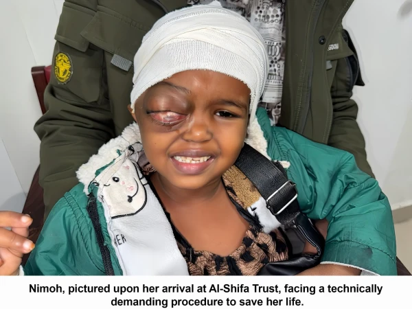 الشفاء ٹرسٹ آئی ہسپتال میں صومالیہ کی بچی کی آنکھ کی رسولی کا کامیاب آپریشن